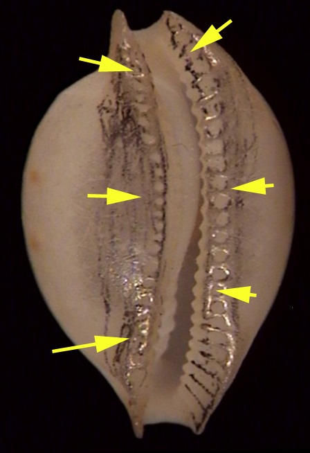 Nesiocypraea lisetae showing characteristic teeth